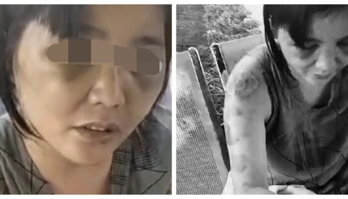 Dijebak Sesama PMI di Arab Saudi, Nurlela Babak Belur di Tangan Pasangan Suami Istri Yaman-Bangladesh