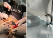 Niat Agar Burungnya Tumbuh Besar, Pria di Thailand Ini Pasang Cincin Khusus! Endingnya Bikin Mules