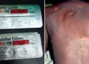 Yang Berada di Singapura Waspadalah Jika Menemukan Obat Ini, 9 Orang Sudah Jadi Korbannya