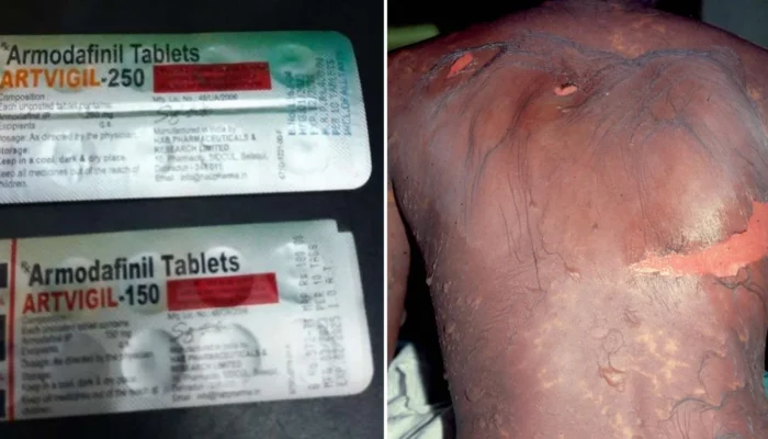 Yang Berada di Singapura Waspadalah Jika Menemukan Obat Ini, 9 Orang Sudah Jadi Korbannya