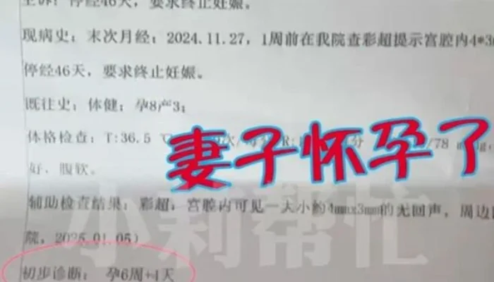 Unik! Wanita di China Hamil Meskipun Suami Sudah Vasektomi, Rumah Sakit Beri Kompensasi S$3.000