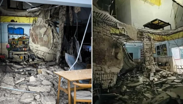Turis Ini Harus Rela Kakinya Diamputasi karena Plafon Restoran yang Runtuh di Malaysia