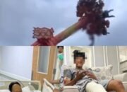 Ngeri! Remaja Terlempar dari Wahana Pendulum 360° Jatim Park 1, Korban Alami Patah Tulang