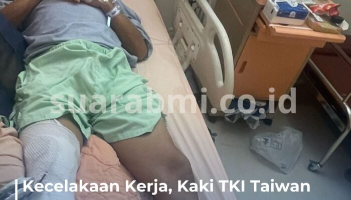 Kecelakaan Kerja, Kaki TKI Taiwan Aroni Diamputasi! Bantuan Segera Dibutuhkan untuk Biaya Pengobatan