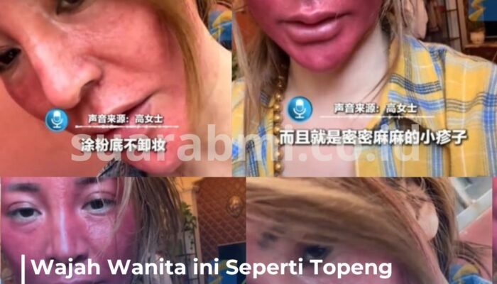 22 Tahun Tak Pernah Hapus Makeup, Wanita Ini Alami Wajah Membengkak Seperti Bertopeng