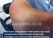 Jalani Diet Ketat agar Bisa Tampil Aduhai, TKI Ini Justru Terjerat Diabetes