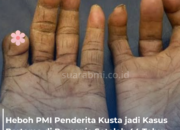 Heboh PMI Penderita Kusta jadi Kasus Pertama di Rumania Setelah 44 Tahun Nihil Temuan